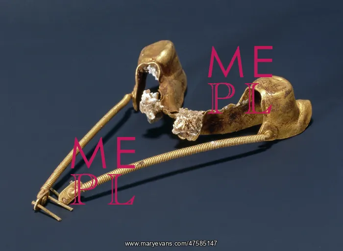 : A gold lower denture : A gold lower denture