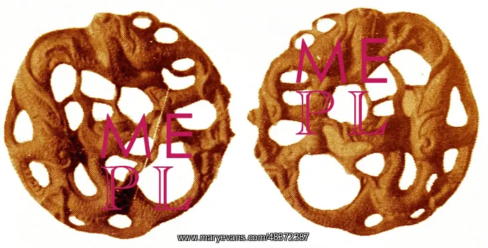  : Gold Ornaments, Koryo (Goreyo)
