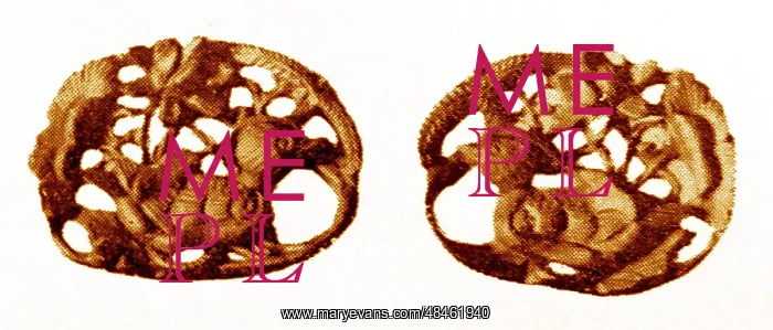 : Gold Ornaments, Koryo (Goreyo) : Gold Ornaments, Koryo (Goreyo)