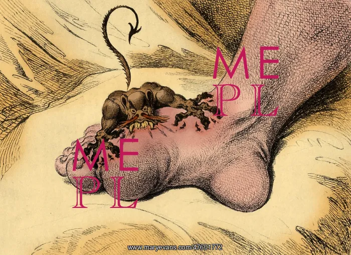 : The Gout. Illustration representing the pain associated with the Gout : The Gout. Illustration representing the pain associated with the Gout