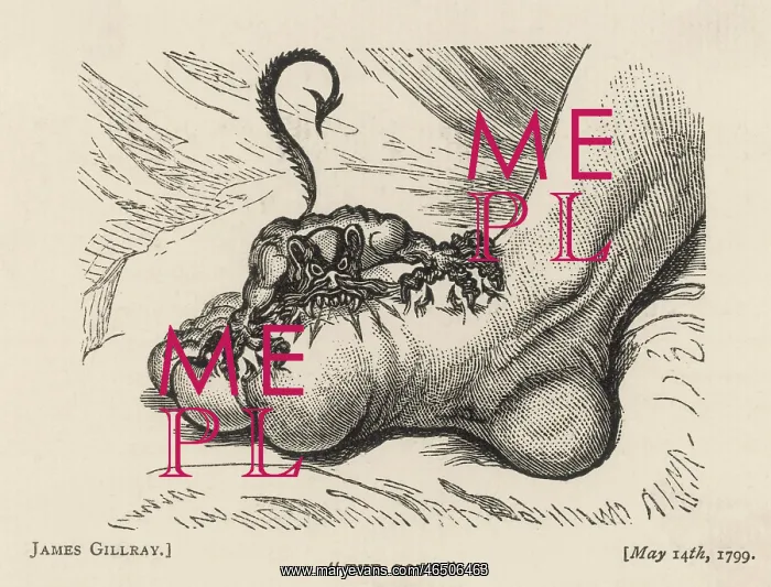 : The Gout Devil Bites - 1799 : The Gout Devil Bites - 1799