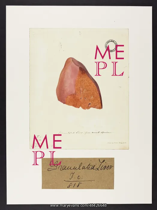 : Granulated Liver : Granulated Liver