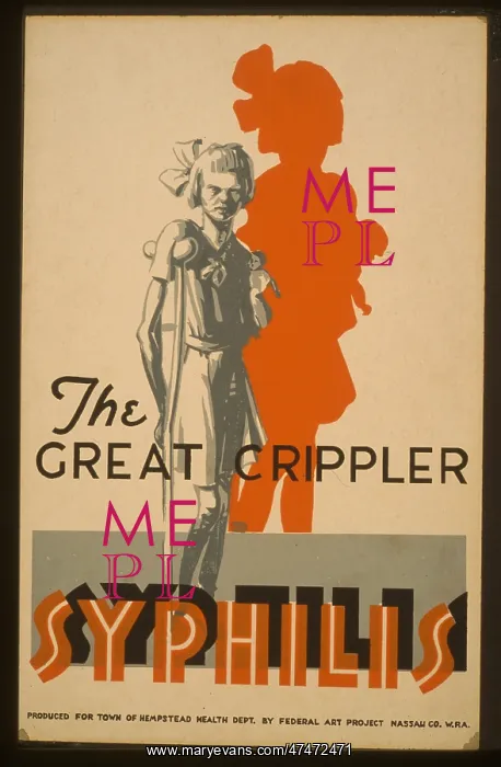 : The great crippler - syphilis : The great crippler - syphilis