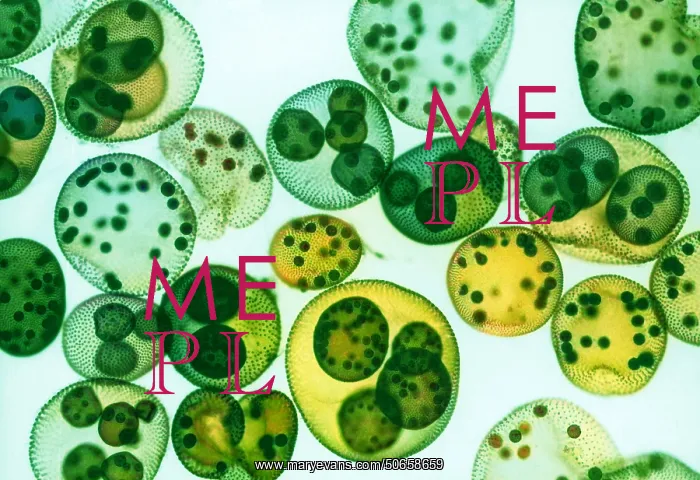 : Green algae, Volvox sp. LM : Green algae, Volvox sp. LM