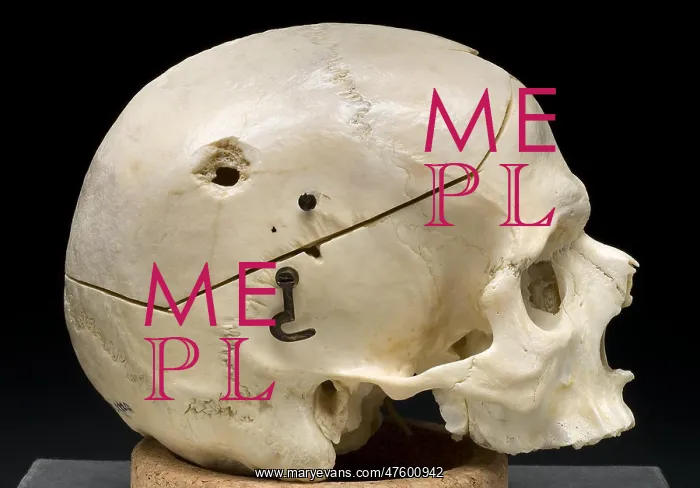 : Gunshot Trauma to Skull, 1950's : Gunshot Trauma to Skull, 1950's