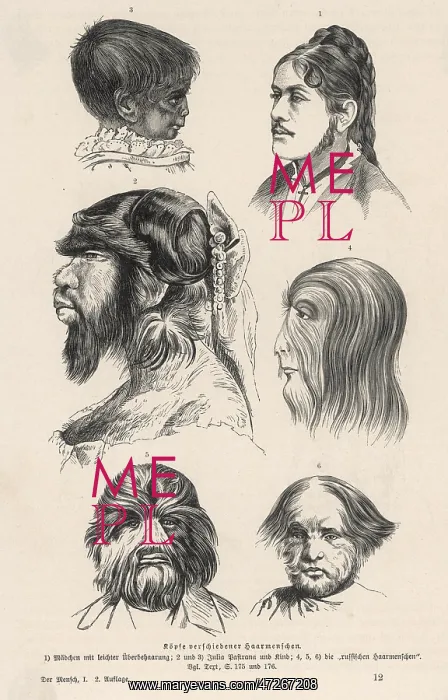 : HAIRY-FACED WOMEN : HAIRY-FACED WOMEN