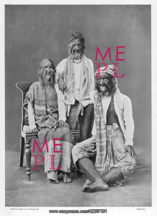  : HAIRY FOLK OF MANDALAY