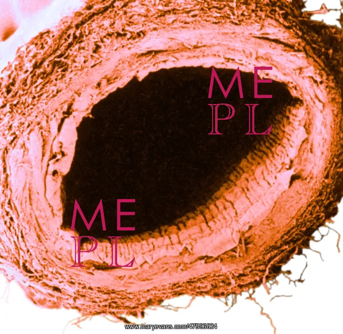 : Healthy Vein, SEM : Healthy Vein, SEM