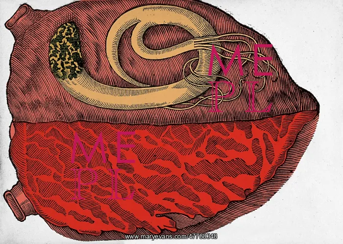 : Heart with Parasite, 1639 : Heart with Parasite, 1639