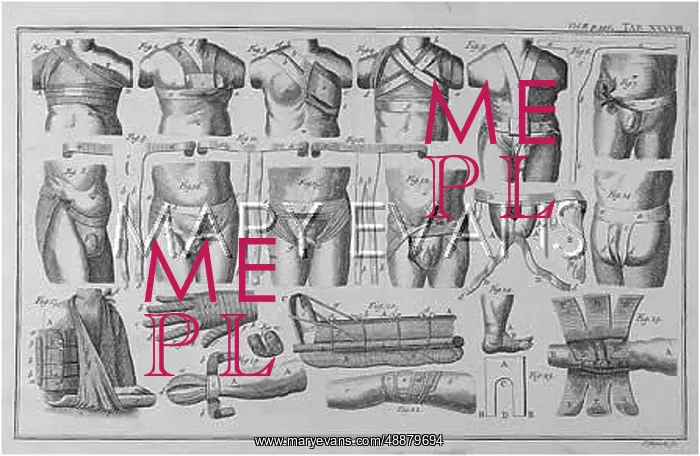  : HEISTER / BANDAGING / 1739
