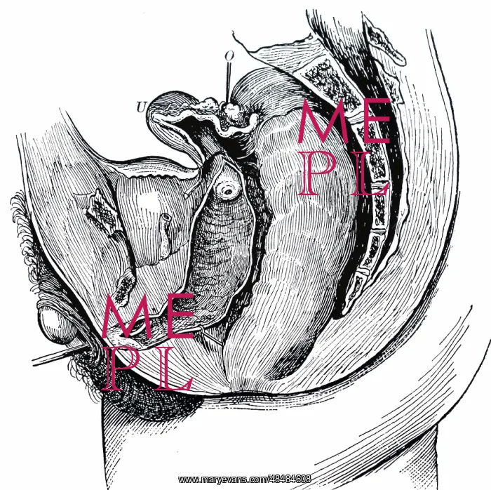: Hermaphroditism: Mesial section showing the generative : Hermaphroditism: Mesial section showing the generative
