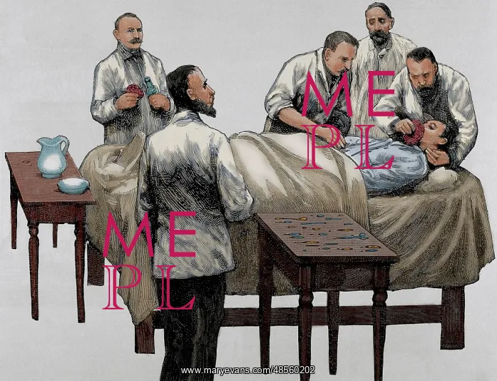 : History of medicine. Chloroform anesthesia. Engraving, 19th : History of medicine. Chloroform anesthesia. Engraving, 19th