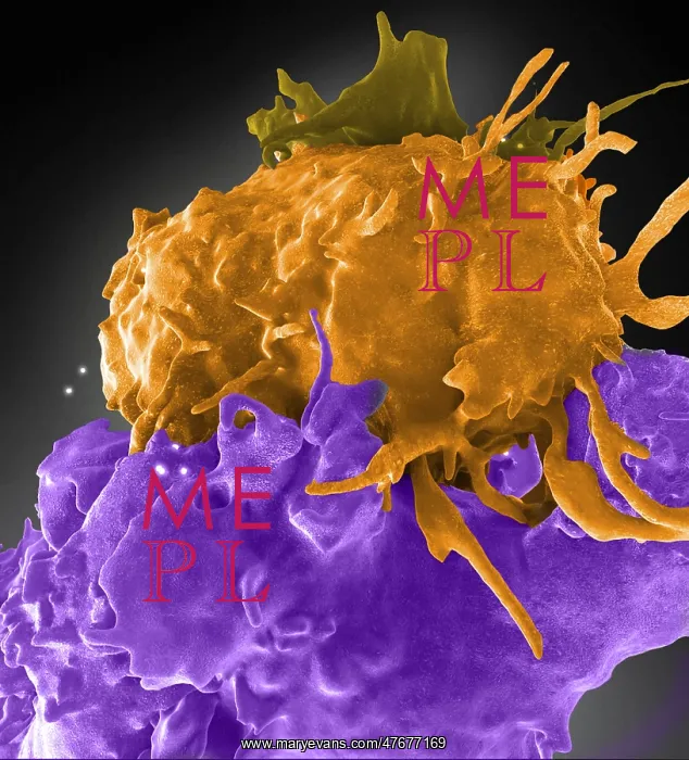 : HIV-Infected and Normal T Cells Interact, FIB-SEM : HIV-Infected and Normal T Cells Interact, FIB-SEM