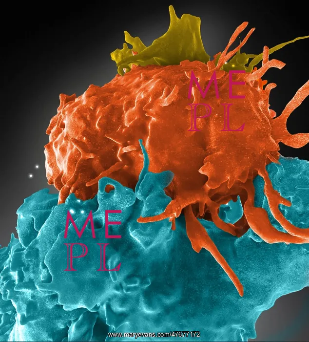 : HIV-Infected and Normal T Cells Interact, FIB-SEM : HIV-Infected and Normal T Cells Interact, FIB-SEM