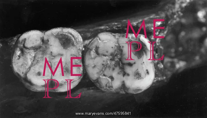 : Homo sapiens molars (Piltdown 1) : Homo sapiens molars (Piltdown 1)