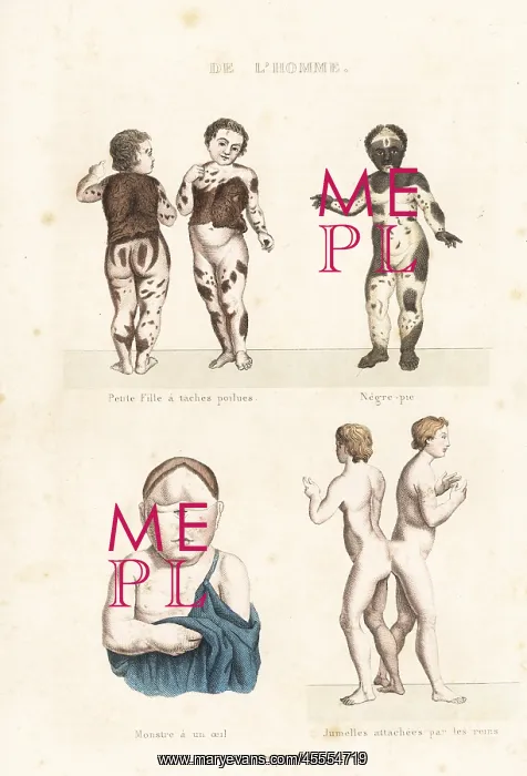 : Human disorders : Human disorders