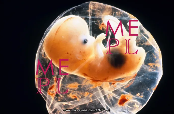 : Human foetus, 5 - 6 weeks : Human foetus, 5 - 6 weeks