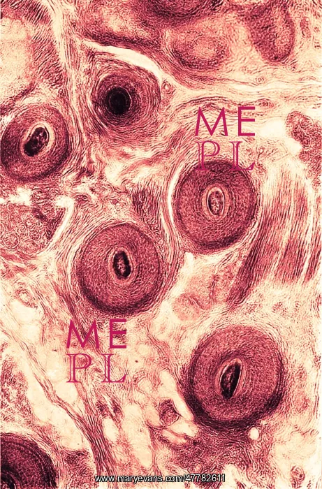 : Human Scalp, Early Photomicrograph : Human Scalp, Early Photomicrograph