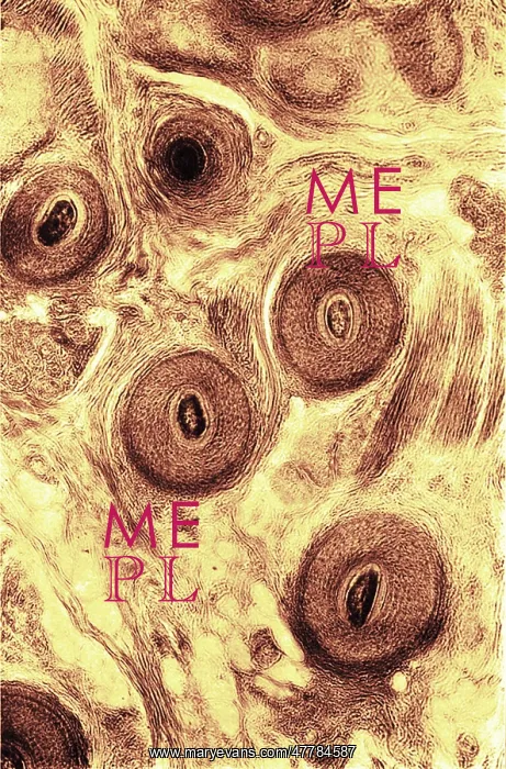 : Human Scalp, Early Photomicrograph : Human Scalp, Early Photomicrograph
