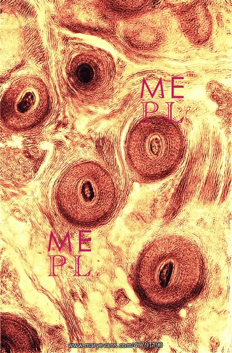 : Human Scalp, Early Photomicrograph : Human Scalp, Early Photomicrograph