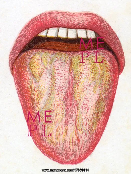  : Human tongue during a fever