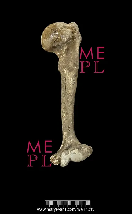 : Humerus of Achondroplastic Dwarf : Humerus of Achondroplastic Dwarf