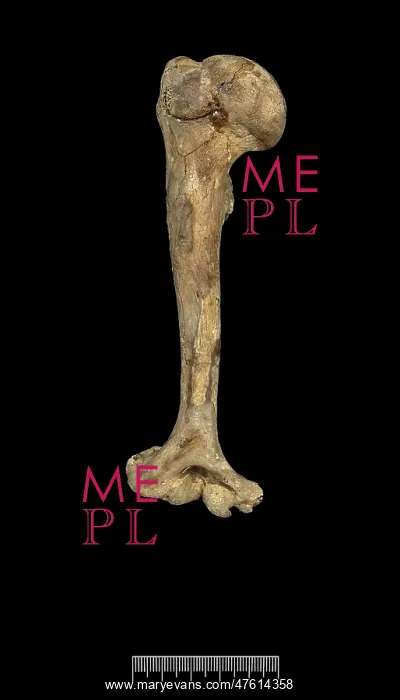 : Humerus of Achondroplastic Dwarf : Humerus of Achondroplastic Dwarf