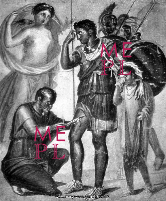 : Iapyx Removing Arrowhead from Leg of Aeneas : Iapyx Removing Arrowhead from Leg of Aeneas