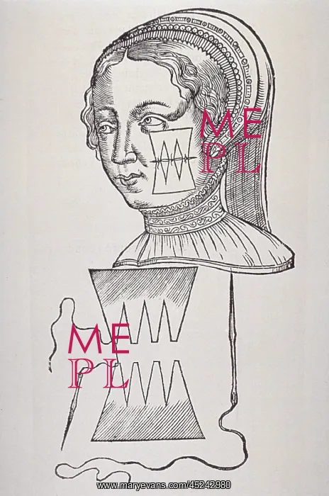  : Illustration of suture technique that minimized ?