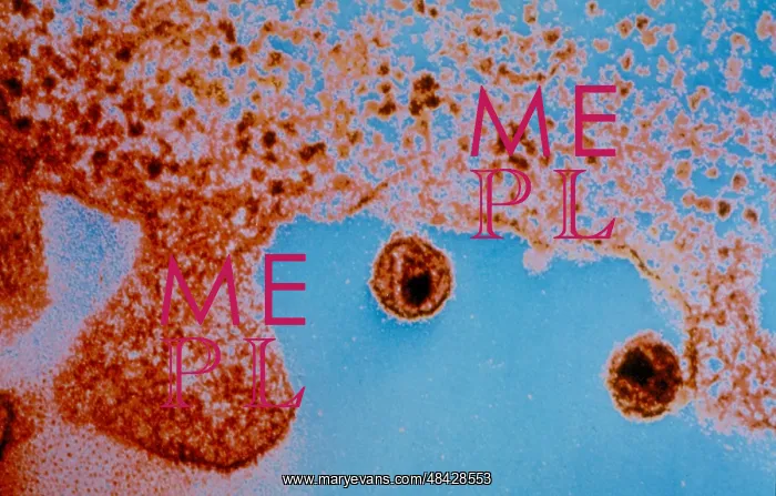 : Image of Aids virus from Uganda. World Health : Image of Aids virus from Uganda. World Health