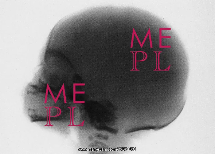 : Infant skull x-ray : Infant skull x-ray
