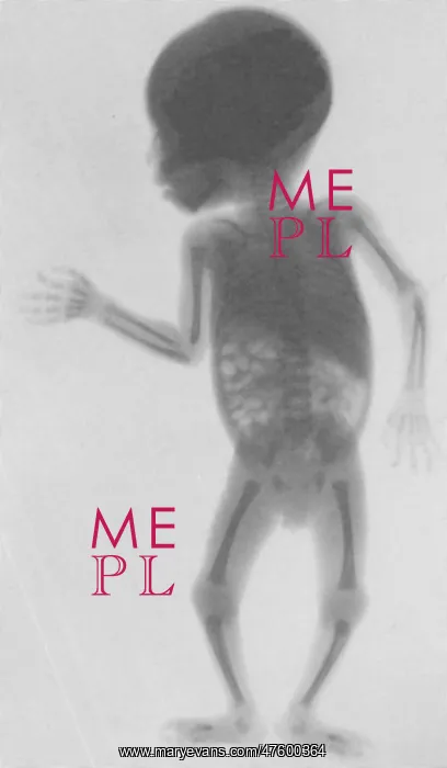 : Infant X-Ray, 1900 : Infant X-Ray, 1900