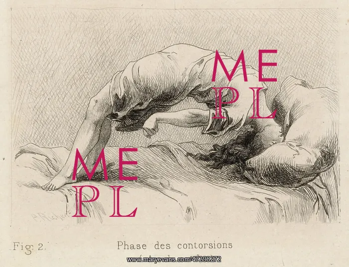 : Insanity - Hysteria - 1881 : Insanity - Hysteria - 1881