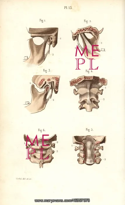 : Jaw bone and neck : Jaw bone and neck