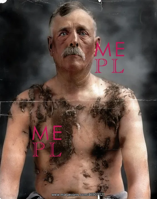 : John Meintz, tarred and feathered in public : John Meintz, tarred and feathered in public