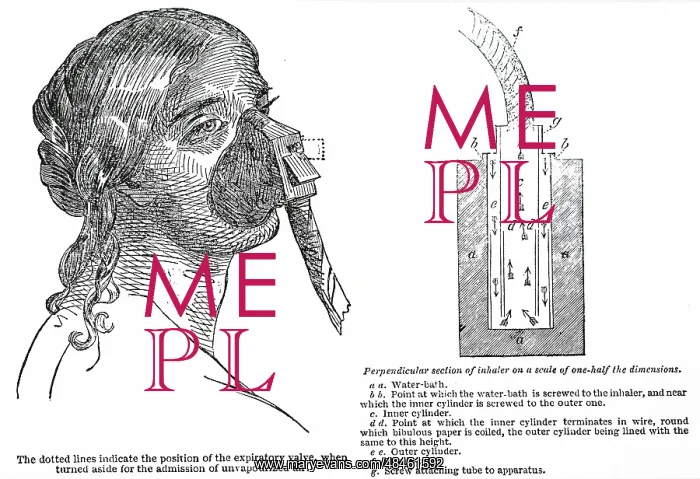 : John Snow's (1813-1858) inhaler for the administration : John Snow's (1813-1858) inhaler for the administration