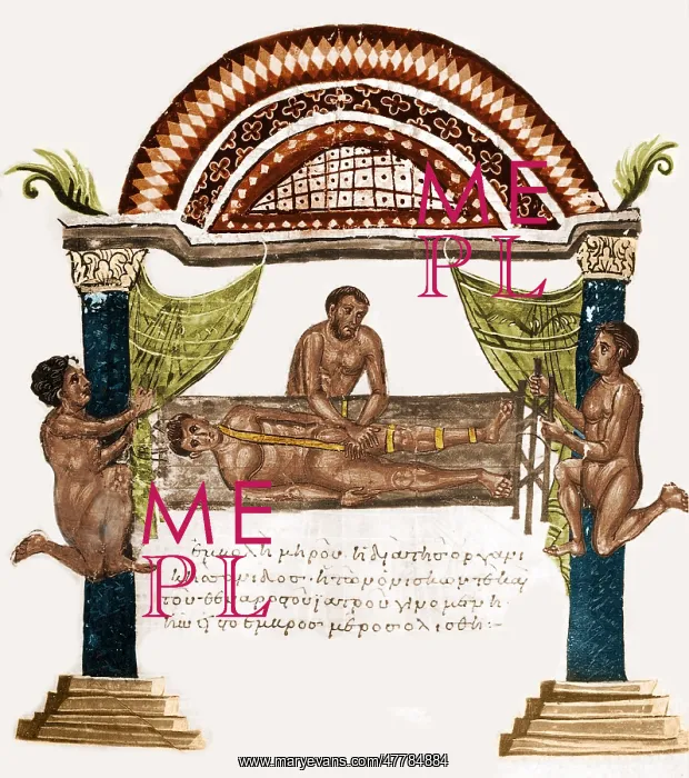 : Joint Dislocation Treatment, 1st Century BC : Joint Dislocation Treatment, 1st Century BC