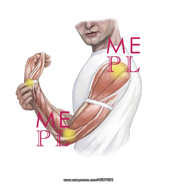 : Joint Pain, Illustration : Joint Pain, Illustration