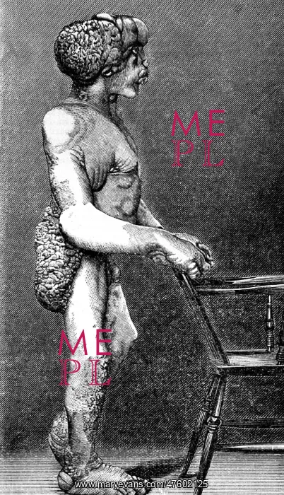 : Joseph Merrick, The Elephant Man : Joseph Merrick, The Elephant Man