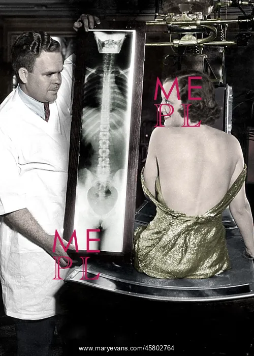 : Just show a little backbone - spinal X-ray : Just show a little backbone - spinal X-ray