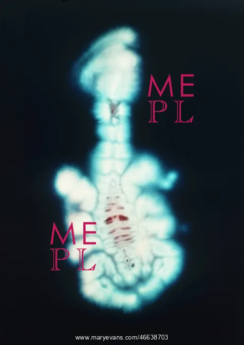  : Kirlian scorpion