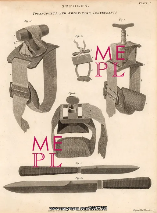 : Knives and tourniquets used for amputation. The : Knives and tourniquets used for amputation. The