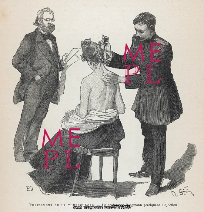 : KOCH'S TUBERCULOSIS CURE : KOCH'S TUBERCULOSIS CURE