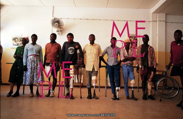 : Landmine victims recuperate and adjust to their recently : Landmine victims recuperate and adjust to their recently