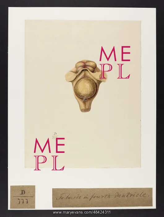 : Large Round Tubercle: Fourth Ventricle of the Brain : Large Round Tubercle: Fourth Ventricle of the Brain