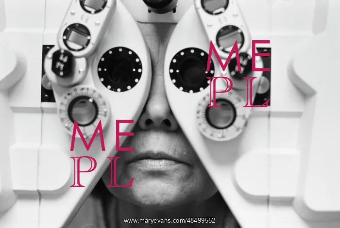 : Lens fitting : Lens fitting
