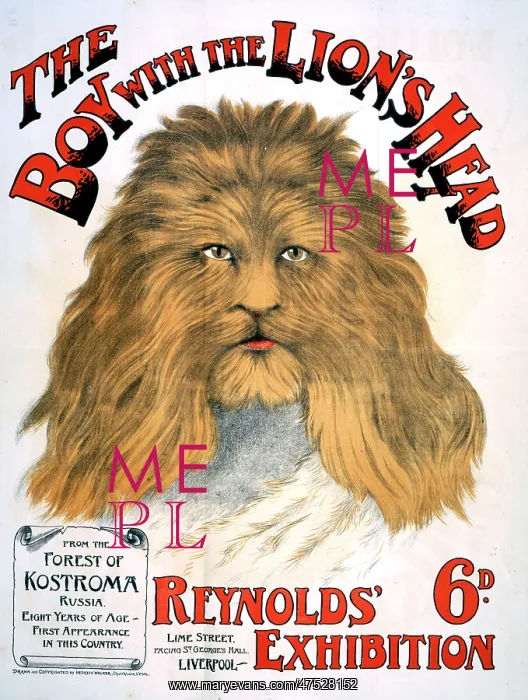 : Lion headed boy