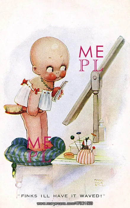 : Little girl with bald head : Little girl with bald head