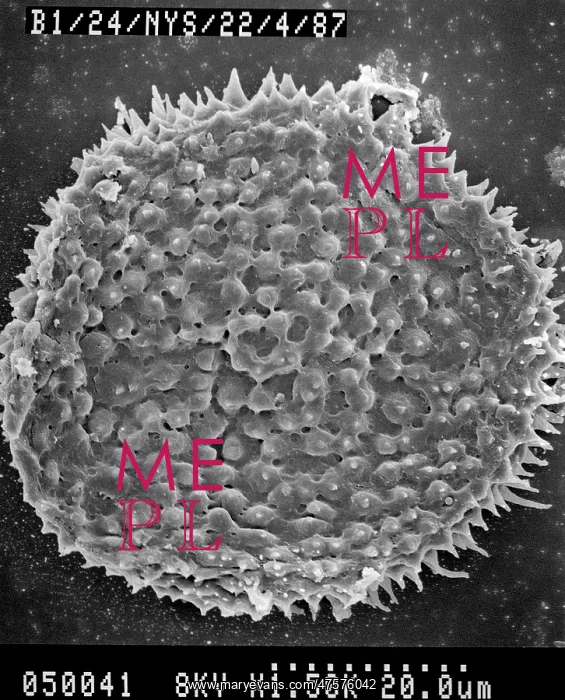 : Lycopod. Scanning electron microscope (SEM) image of spores from a mid Devonian lycopod : Lycopod. Scanning electron microscope (SEM) image of spores from a mid Devonian lycopod