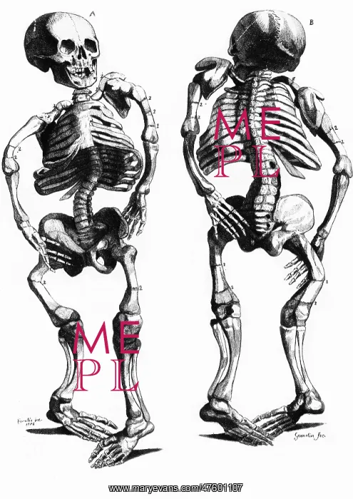 : Malformed Skeletons : Malformed Skeletons
